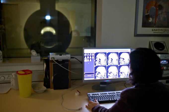 Forscher der Universität Zürich untersuchen Hirnscans. (Archivbild) Hirnforschung Uni Zürich
