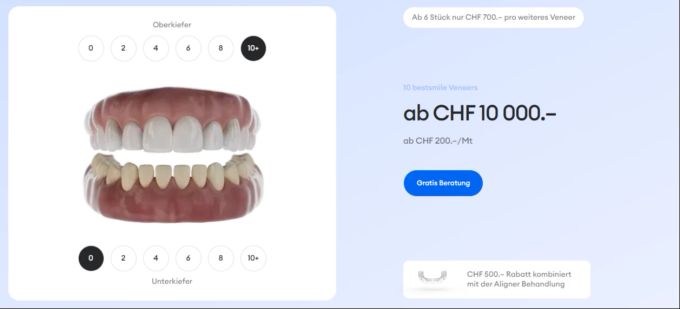 Veneers