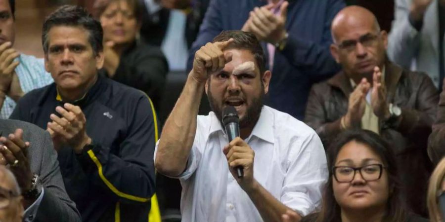 Der wegen eines mutmasslichen Anschlags auf den venezolanischen Präsidenten Nicolás Maduro festgenommene Oppositionspolitiker Juan Requesens (m.) spricht im April 2017 an der nationalen Versammlung in Caracas. Requesens wurde zwei Tage zuvor von Pro-Regierungs-Gruppen angegriffen und im Gesicht verletzt.