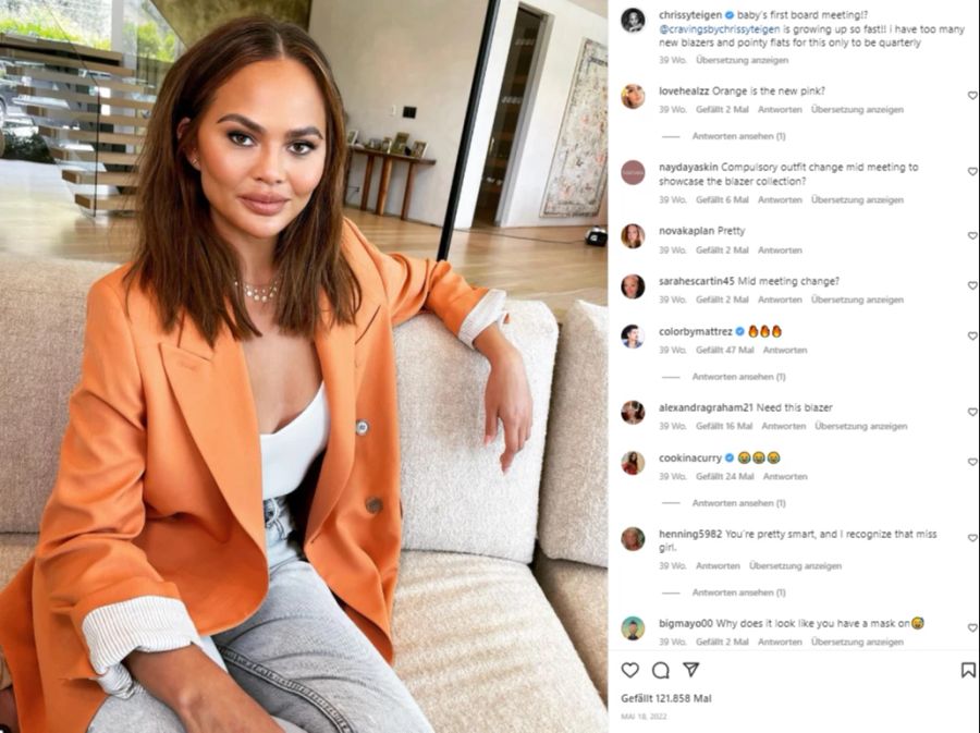 Chrissy Teigen hat sich dem Schönheitseingriff unterzogen.
