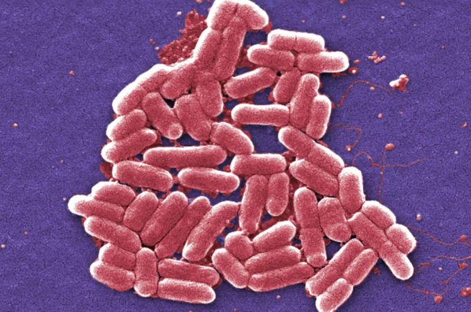 E. Coli unter dem Rasterelektronenmikroskop: Die Bakterie ist für verschiedenste Erkrankungen verantwortlich. E. Coli Baden Wasser