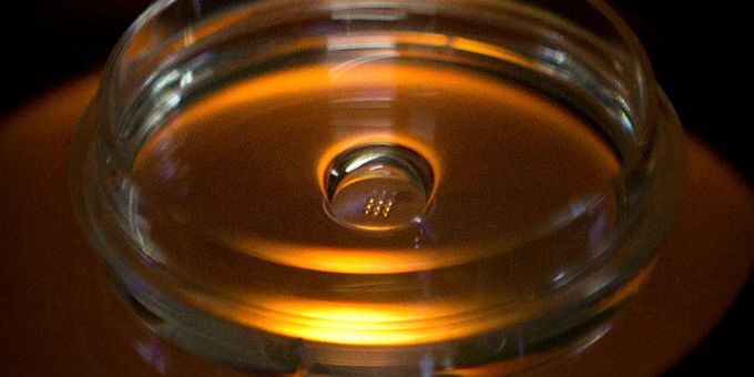 ARCHIV - 09.10.2018, China, Shenzhen: Eine Mikroplatte mit Embryonen, die mit Cas9-Protein und PCSK9 sgRNA injiziert wurden, ist in einem Labor in Shenzhen in der südchinesischen Provinz Guangdong zu sehen. Embryonen