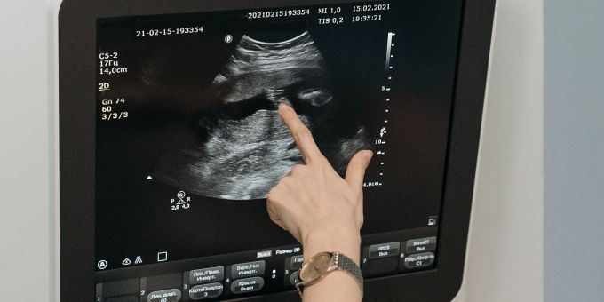 48h-Beobachtung - Neue Ultraschall-Sticker am MIT entwickelt