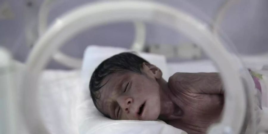 Ein unterernährtes Neugeborenes liegt in einem Inkubator im internationalen Krankenhaus UniMax in Sanaa. Foto: Hani Al-Ansi/dpa