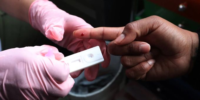 Das RKI hat eine vorläufige Schätzung zur Anzahl der Neuinfektionen mit HIV veröffentlicht. (Symbolbild) HIV Test