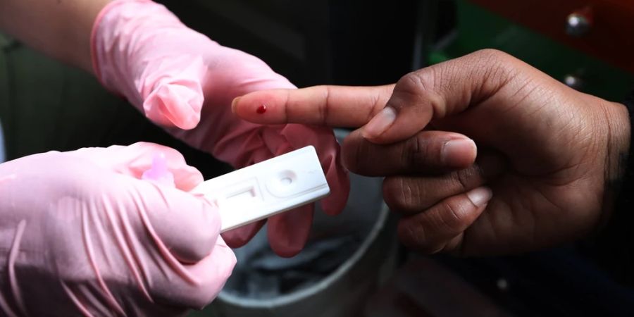 HIV Test