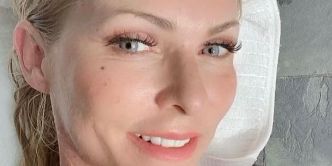 «Ökolifting» - Hier zeigt sich Sonya Kraus (50) plötzlich faltenfrei