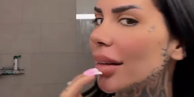 «Entenschnabel» weg! - «Bachelor»-Star Mia Madisson zeigt neue Lippen