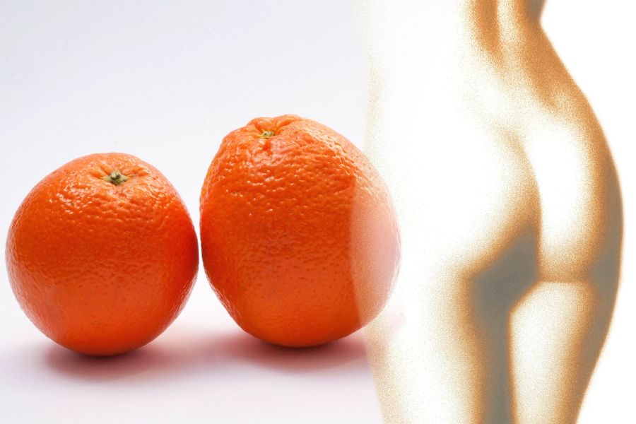 Orangen orange Frauenkörper Po Oberschenkel Cellulite