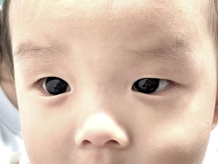 Die ursprüngliche Augenfarbe des Babys ist braun. Das Kind hatte vorübergehend blaue Augen.