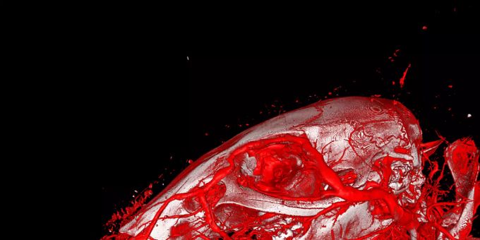 Dreidimensionale Darstellung der Blutgefässe eines Mäusekopfes mit Hilfe von Röntgencomputertomografie und des neu entwickelten Kontrastmittels XlinCA. Dreidimensionale Darstellung der Blutgefässe eines Mäusekopfes mit Hilfe von Röntgencomputertomografie und des neu entwickelten Kontrastmittels XlinCA.