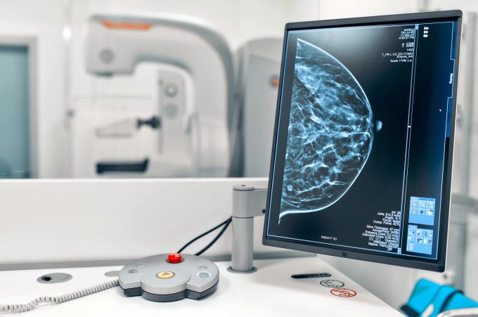 Brustkrebs kann auch mit Medikamenten behandelt werden. Brustkrebs