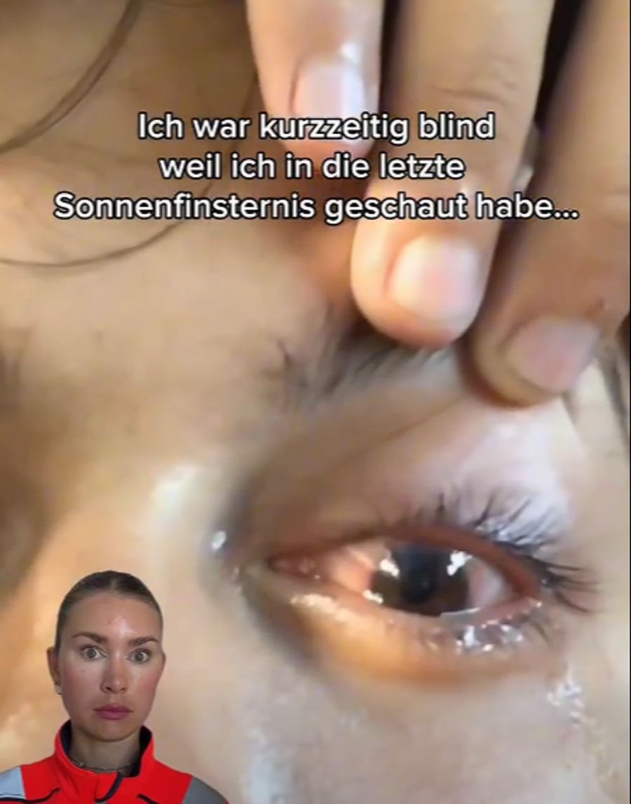 augen