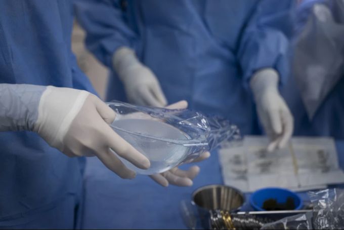 Brustvergrösserung Operation Schönheit
