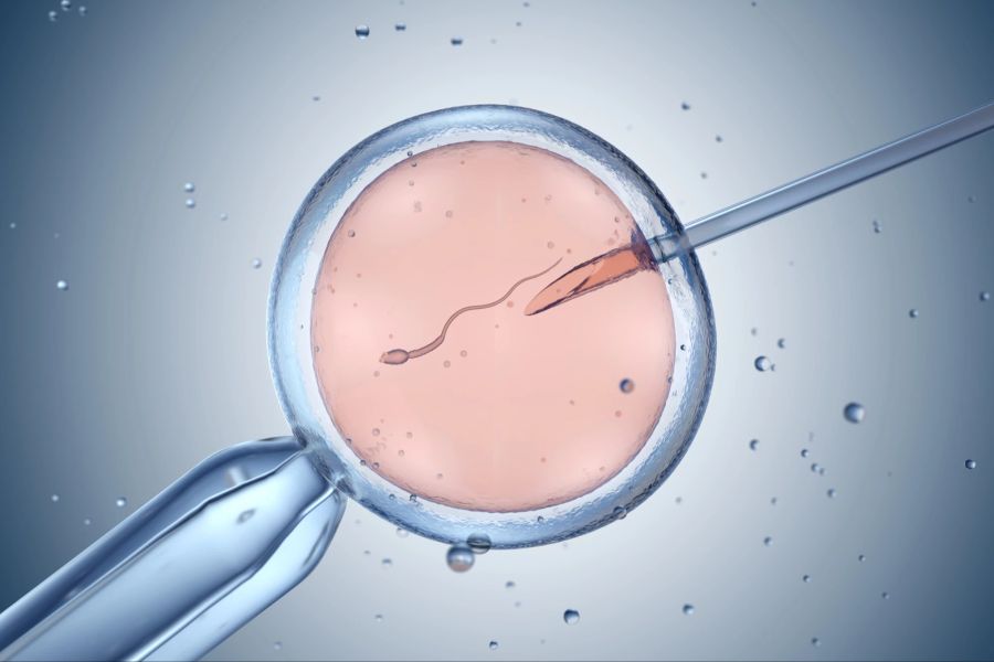 In-vitro-Fertilisation (IVF)