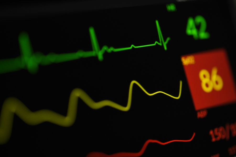 EKG