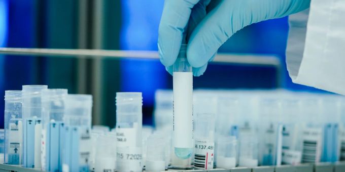 Die Gesundheitsämter in Deutschland meldeten dem RKI zuletzt 38.668 Corona-Neuinfektionen. Die Gesundheitsämter in Deutschland meldeten dem RKI zuletzt 38.668 Corona-Neuinfektionen.