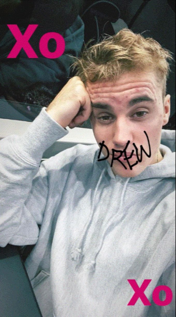Justin Bieber zeigt sich mit Pickeln im Gesicht. hochzeit justin bieber