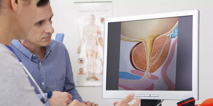 Prostataleiden und ihre Begleitbeschwerden nagen auch am männlichen Selbstbewusstsein. Prostata Prophilaxe Vorbeugung