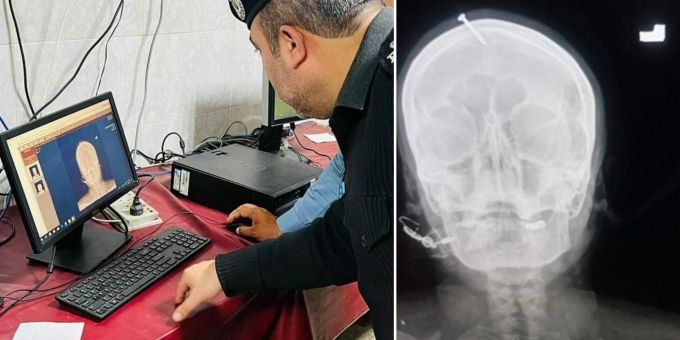 Wollte einen Jungen - «Wunderheiler» hämmert Schwangerer Nagel in Kopf