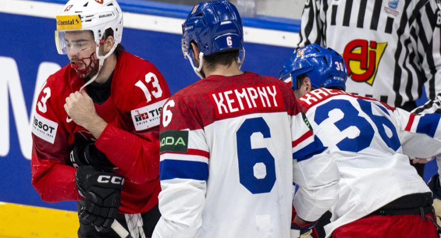 Nico Hischier (l.) wird gegen Tschechien von einer Schlittschuhkufe im Gesicht getroffen. Er verschwindet kurz in die Garderobe und ist wenig später wieder zurück auf dem Eis.