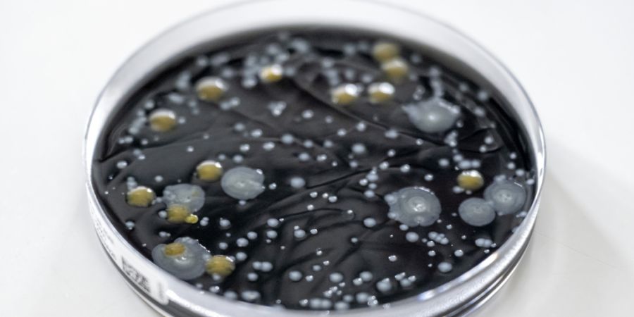 Legionellen
