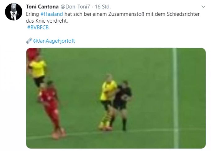 Hat sich Erling Haaland im Spiel BVB - Bayern wegen Schiedsrichter Tobias Stieler verletzt? Haaland