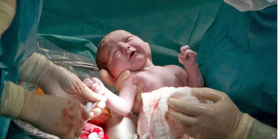 Ein Arzt hält im Kreisssaal einer Frauenklinik ein neugeborenes Baby, das per Kaiserschnitt zur Welt kam, in den Händen.