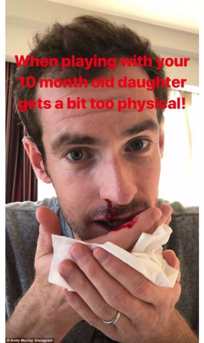 Andy Murrays zehn Monate alte Tochter hat ihm die Nase blutig geschlagen. Andy Murrays zehn Monate alte Tochter hat ihm die Nase blutig geschlagen.