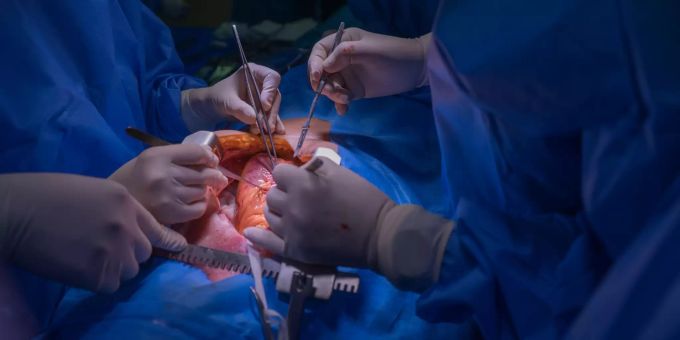 Ob ein Herz zur Organspende entnommen werden darf, hängt vom Hirntod des Spenders ab. Bild: iStock Ob ein Herz zur Organspende entnommen werden darf, hängt vom Hirntod des Spenders ab. Bild: iStock