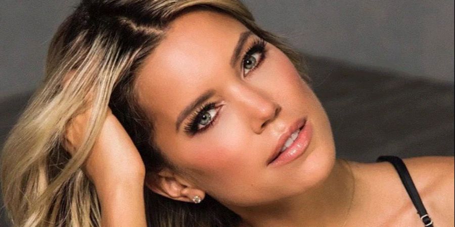 Sylvie Meis findet Beauty-OPs seien kein «absolutes Tabu».