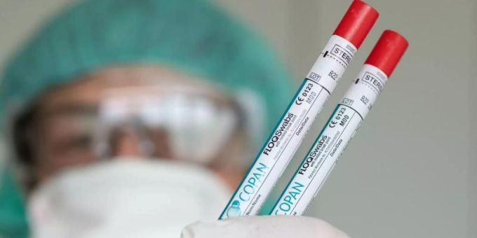 Abstrich werden im Labor auf das neuartige Coronavirus getestet. coronavirus labor