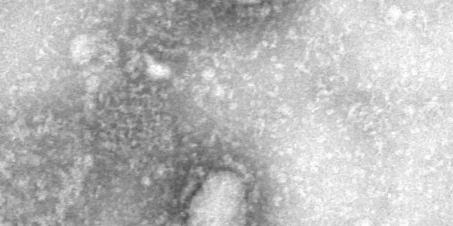 Das Coronavirus breitet sich mit einer enormen Dynamik aus. Foto: IVDC/China CDC via GISAID/dpa
