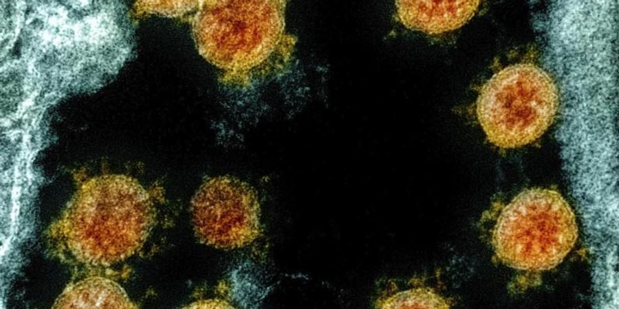 Eine elektronenmikroskopische Aufnahme zeigt Partikel des Coronavirus SARS-CoV-2. Foto: Uncredited/NIAID/NIH/dpa