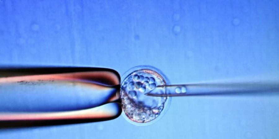 Baby in Japan erfolgreich mit Stammzellen behandelt