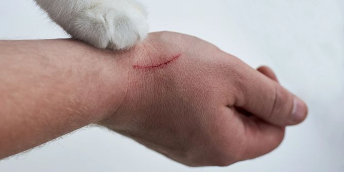 Ein Katzenkratzer schmerzt und brennt oft intensiv.