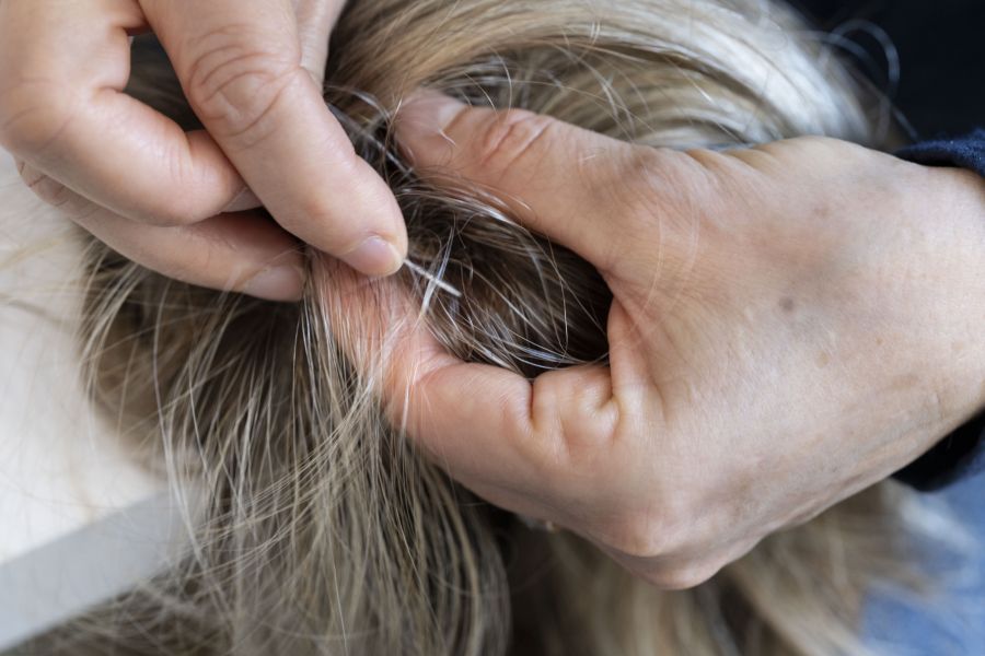 Einige Brandopfer schöpfen aus der Aktion bereits Mut: Bisher gingen sieben Perücken-Bestellungen ein. (Symbolbild)