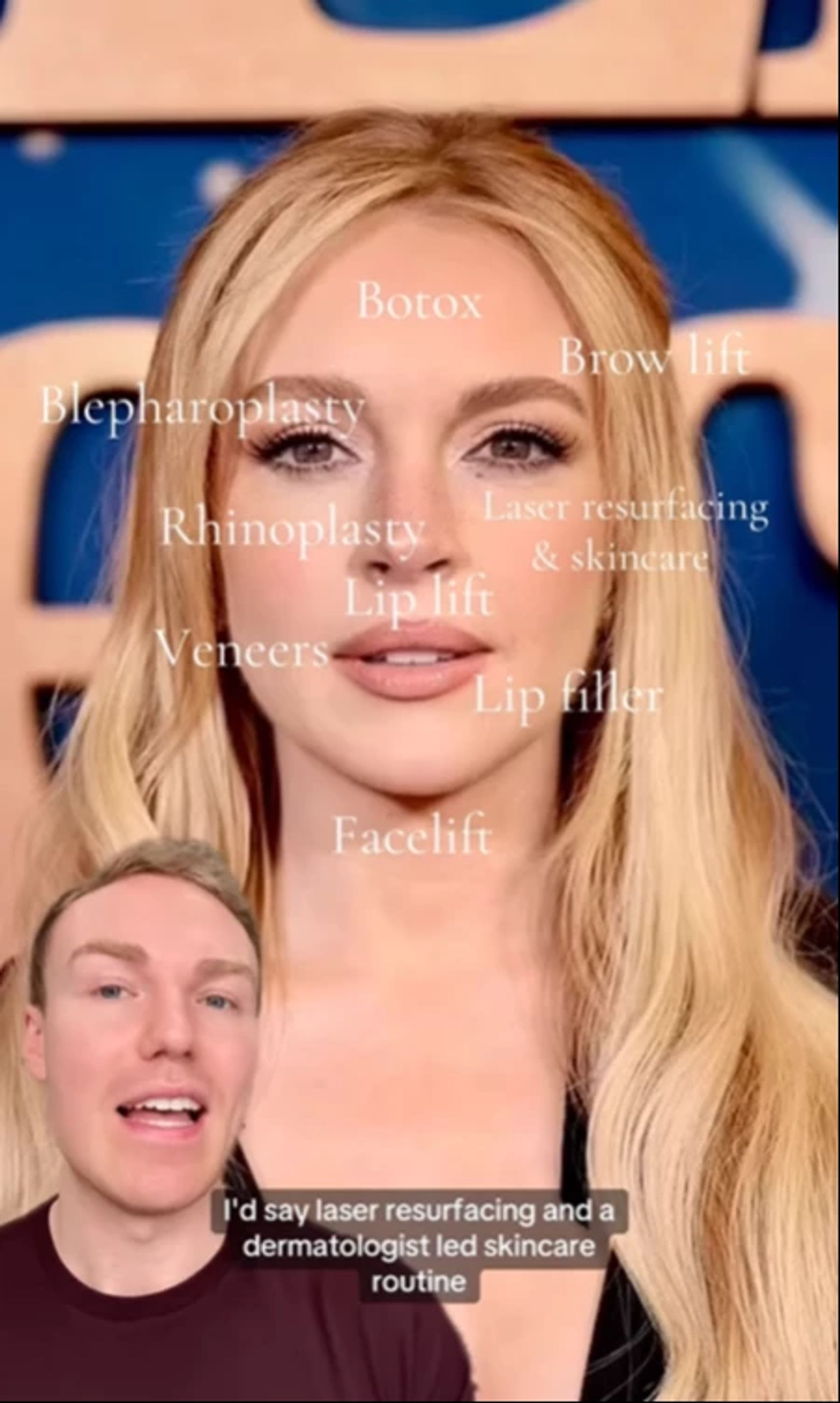 Sie Sieht Aus Wie Ne Türkin Song Chirurg glaubt: Lindsay Lohan gab 280'000 Franken für Beauty-OPs aus