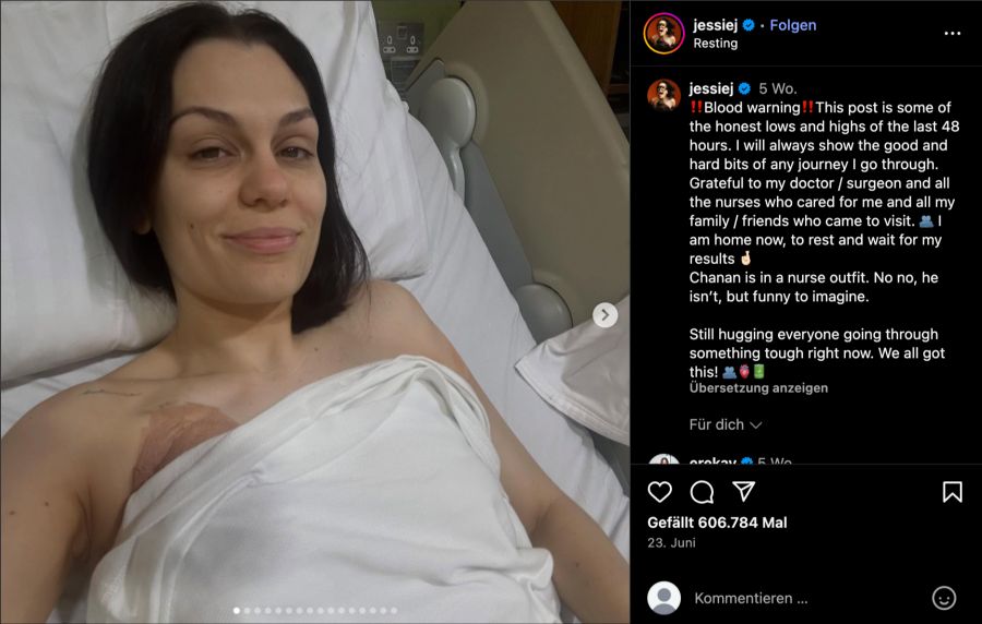 brustkrebs op jessie j