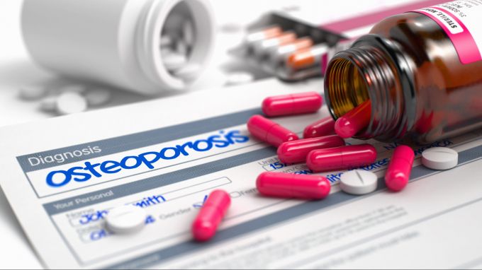 Osteoporose kann mit Medikamenten und Nährstoffen behandelt und vorgebeugt werden. Osteoporose
