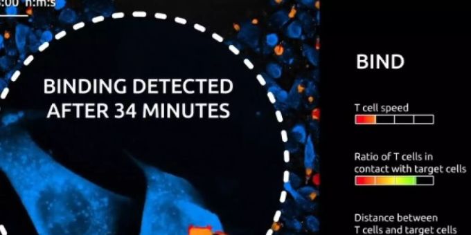 Der neuartige Test Live T Cell Assay lässt Wissenschaftler live teilhaben an der Interaktion zwischen Immun- und Krebszellen. Hier wurde der Moment erfasst, in dem eine Immunzelle an die Krebszelle andockt (Screenshot Nanolive) Der neuartige Test Live T Cell Assay lässt Wissenschaftler live teilhaben an der Interaktion zwischen Immun- und Krebszellen. Hier wurde der Moment erfasst, in dem eine Immunzelle an die Krebszelle andockt (Screenshot Nanolive)