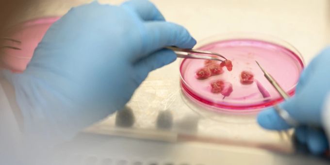 Diskurs - Italien verbietet Laborfleisch: Tradition oder Rückschritt?