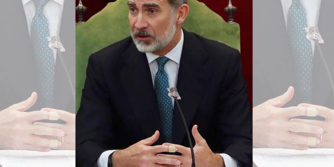 Spanier rätseln - König Felipe immer wieder mit Pflastern gesichtet
