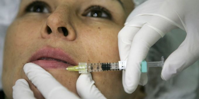 Eine Frau lässt sich die Lippen aufspritzen. (Symbolbild) botox face-filler