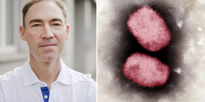 Jan Fehr warnt, dass die Affenpocken die breite Bevölkerung befallen könnten. Affenpocken