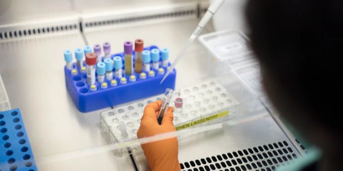 Die Studentin soll sich beim Forschen an der Uni Genf mit dem HI-Virus angesteckt haben. (Symbolbild) HIV Diagnostik Forscherin