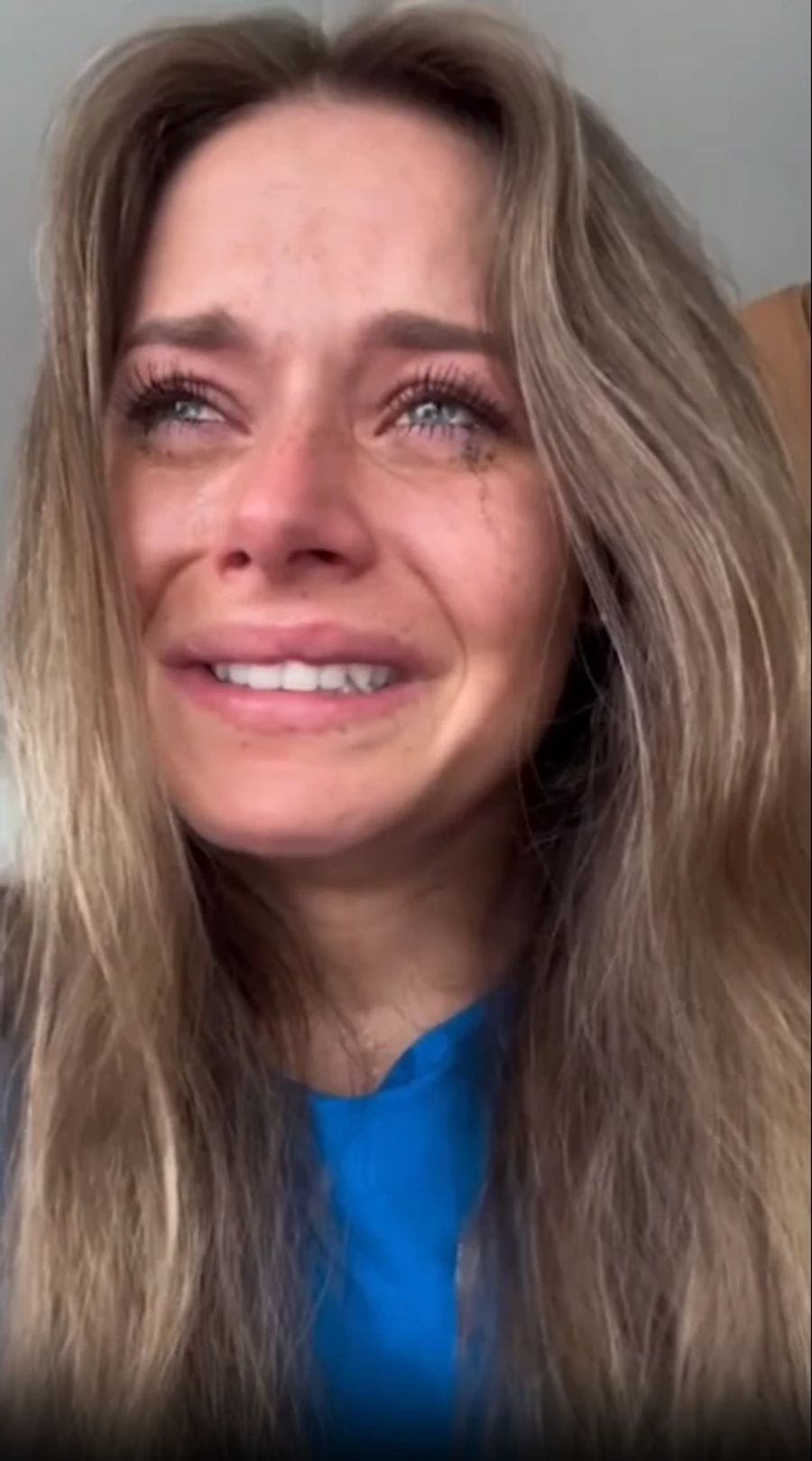 Corinne Suter postet ein emotionales Tränenvideo aus der Reha auf Instagram.