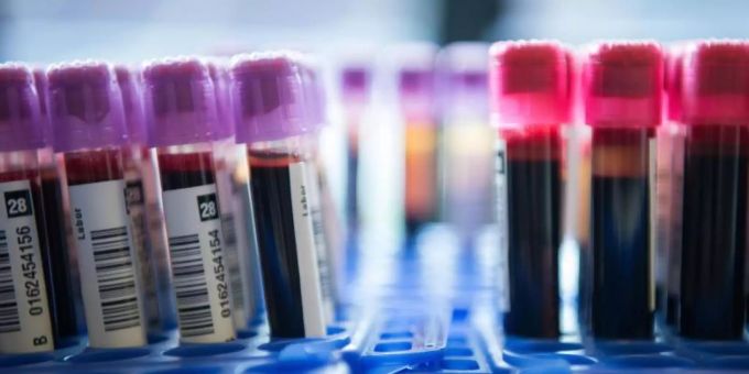 Spezielle Tests können Erbgut von Krebszellen im Blut nachweisen. Foto: picture alliance / dpa Spezielle Tests können Erbgut von Krebszellen im Blut nachweisen. Foto: picture alliance / dpa