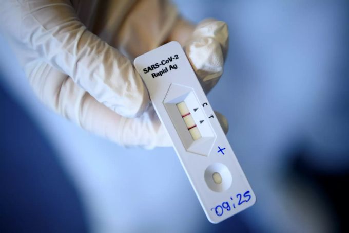 In den USA mussten rund 200.000 Antigen-Tests zurückgerufen werden. (Symbolbild) Firma Ellume