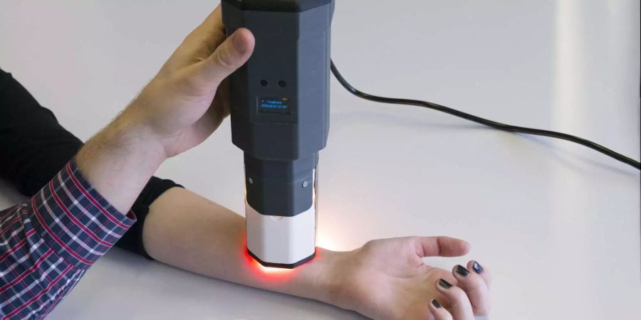 Das neue Gerät der Forscher der ZHAW nutzt Wärme, um die Hautkrankheit Leishmaniose zu heilen. (Bild: ZHAW)